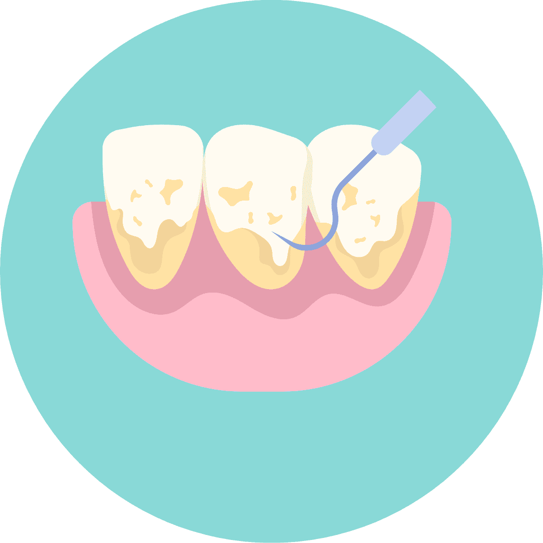 Periodoncia puerto montt
